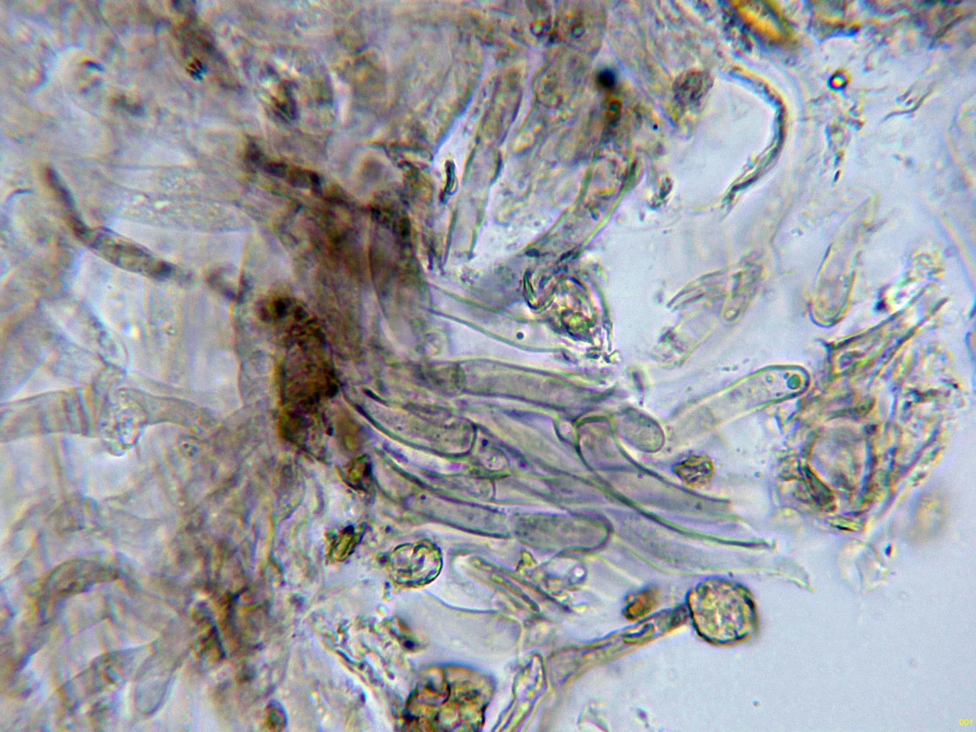 Microscopía de Sarcodon leucopus - 10 - Hifa fibulada agua-001